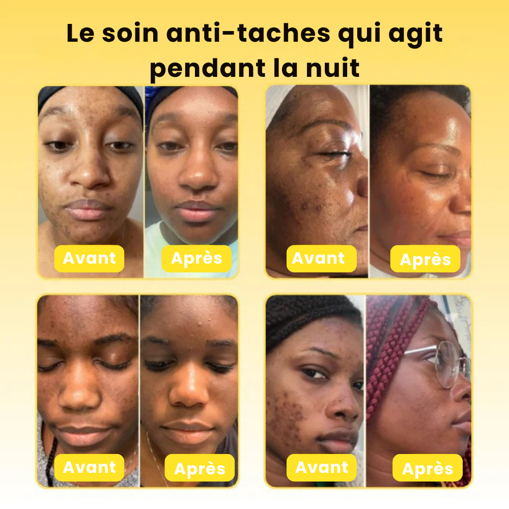 Masque de nuit au curcuma et à l'acide kojique Peel-Off